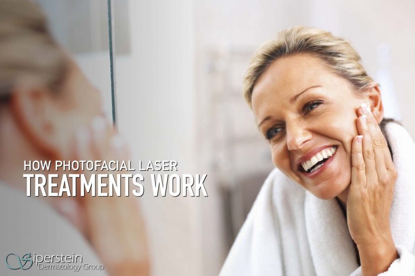 laser treatments