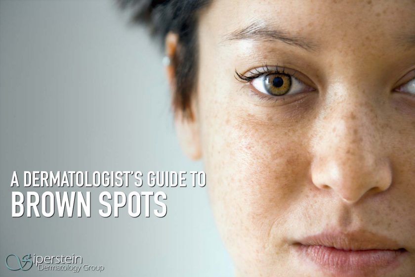 Brown Spots