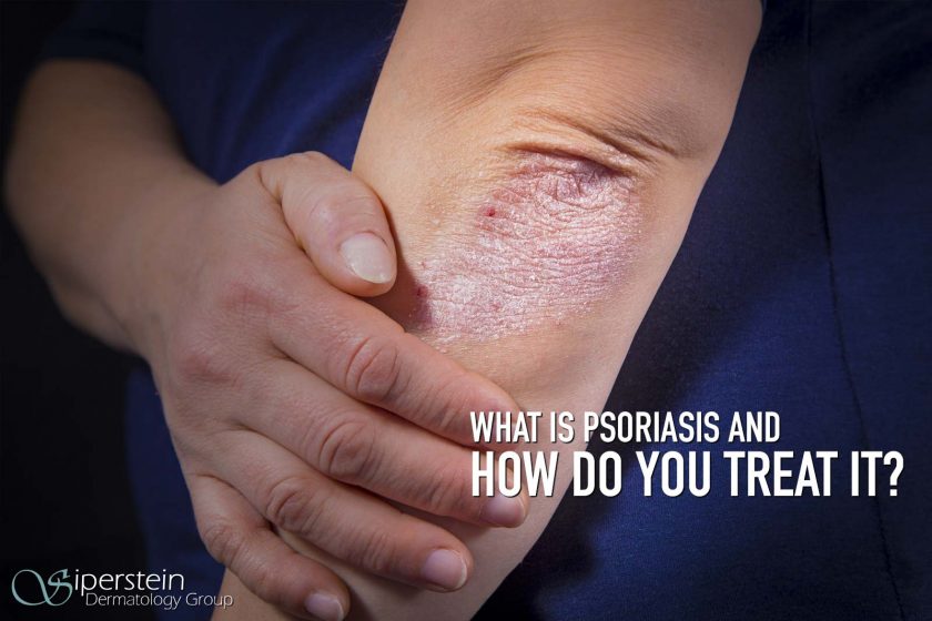 Psoriasis
