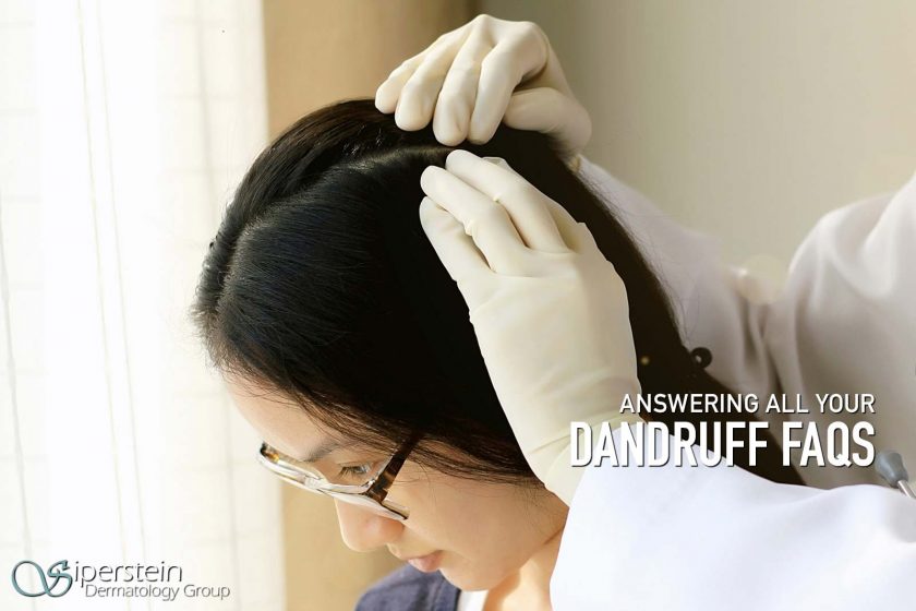 Dandruff