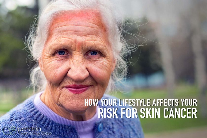 skin cancer